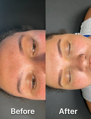 Microblading - Before, mapping, and after of microblading