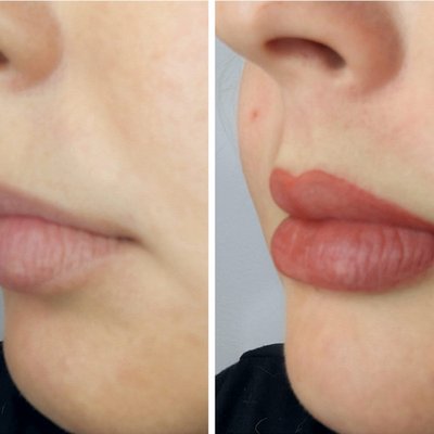 Lip Gallery - Explore a variety of permanent lip enhancements, designed to suit every style. From defined Lip Liner for a subtle contour, to the soft, gradient effect of a Lip Fade, or the bold, full-color transformation of Full Lips. For those seeking a more defined, crisp outline with added dimension, the High Definition Lip offers precision and shape. This gallery showcases the versatility and artistry of permanent makeup to enhance and redefine your lips, offering both natural and bold results. Lip Gallery - Explore a variety of permanent lip enhancements, designed to suit every style. From defined Lip Liner for a subtle contour, to the soft, gradient effect of a Lip Fade, or the bold, full-color transformation of Full Lips. For those seeking a more defined, crisp outline with added dimension, the High Definition Lip offers precision and shape. This gallery showcases the versatility and artistry of permanent makeup to enhance and redefine your lips, offering both natural and bold results.