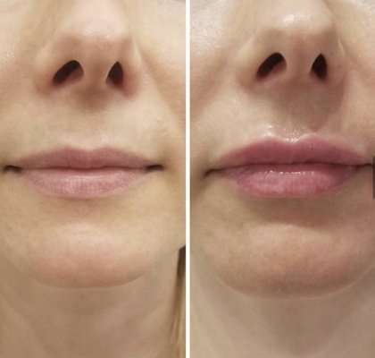 See more of my work! - Love enhancing your beauty! See more of my work! - Love enhancing your beauty!