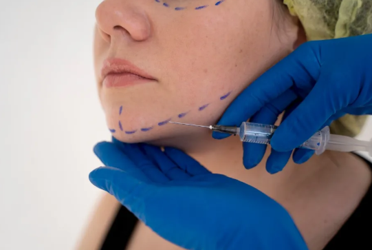 Botox Treatment - Call for more info 5162233117 Botox Treatment - Call for more info 5162233117