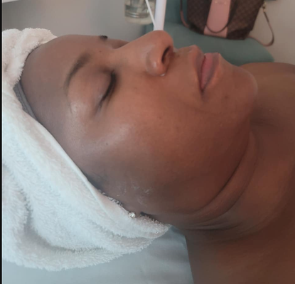 Hydration Facial - Hydration Facial
Before and After Hydration Facial - Hydration Facial
Before and After