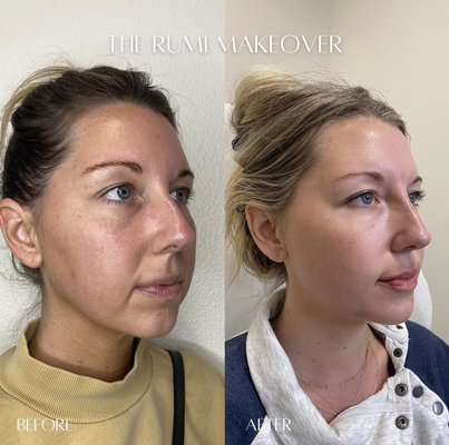 Our Signature Packages - @beautynurseangie takes her time to make you feel comfortable and help you achieve the dream look you’ve been wanting. Our Signature Packages - @beautynurseangie takes her time to make you feel comfortable and help you achieve the dream look you’ve been wanting.