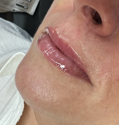 LIP BLUSHING - Lip blushing is a type of semipermanent cosmetic tattooing procedure achieved by depositing pigments in your lips using small needles. While also sometimes called lip tattooing, this is more of a cosmetic enhancement rather than traditional tattoo art. LIP BLUSHING - Lip blushing is a type of semipermanent cosmetic tattooing procedure achieved by depositing pigments in your lips using small needles. While also sometimes called lip tattooing, this is more of a cosmetic enhancement rather than traditional tattoo art.