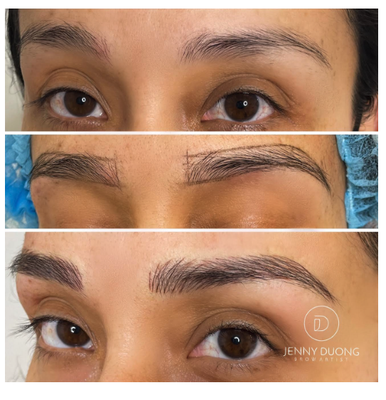 MICROBLADING - The most natural looking brows by creating hyper realistic hair strokes that mimic your own. Ideal for dry to combination skin types. MICROBLADING - The most natural looking brows by creating hyper realistic hair strokes that mimic your own. Ideal for dry to combination skin types.