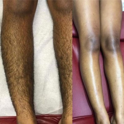 Leg wax - Male leg wax Leg wax - Male leg wax