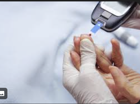 Diabetes Care - Diabetes is a chronic condition that occurs when the body can't produce or use insulin properly, resulting in high blood sugar levels. Insulin is a hormone that helps glucose enter cells, where it's converted into energy or stored. Call now to schedule a new patient appointment. Diabetes Care - Diabetes is a chronic condition that occurs when the body can't produce or use insulin properly, resulting in high blood sugar levels. Insulin is a hormone that helps glucose enter cells, where it's converted into energy or stored. Call now to schedule a new patient appointment.