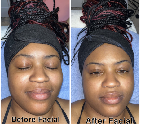 Facials & Skin Care - Looking for that fresh, youthful glow? We offer a variety of skincare and facial services to help those suffering from severe to moderate acne. To learn more or to book an appointment, please call or text (815) 295-3949
.