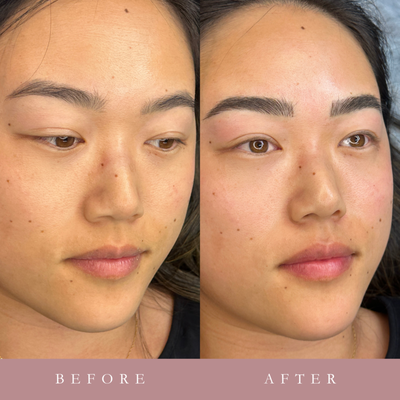 Nano Brows - Nano Brows is a semi-permanent makeup technique that uses an ultra-fine, flexible needle to create precise, natural-looking hair strokes for fuller and more defined eyebrows. Nano Brows - Nano Brows is a semi-permanent makeup technique that uses an ultra-fine, flexible needle to create precise, natural-looking hair strokes for fuller and more defined eyebrows.