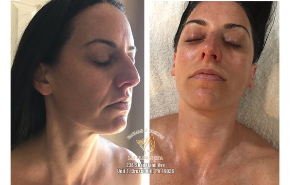 Anti-Aging Rejuvenation Facial - Anti-aging rejuvenating facial (no active breakouts). This facial is ideal for skin concerns such as loss of firmness, fine lines & wrinkles. Includes, enzymatic exfoliation, deep facial and neck and decollete relaxing massage, firming mask serums and creams. Anti-Aging Rejuvenation Facial - Anti-aging rejuvenating facial (no active breakouts). This facial is ideal for skin concerns such as loss of firmness, fine lines & wrinkles. Includes, enzymatic exfoliation, deep facial and neck and decollete relaxing massage, firming mask serums and creams.