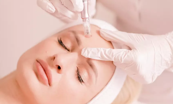 Microneedling - Microneedling is a minimally invasive treatment that stimulates collagen production and creates tiny channels in the skin that absorb 2000% (compared to what your skin would absorb if you just applied it normally) of the stem cell serum that I apply after the treatment. It reduces fine lines and wrinkles, improves hyperpigmentation, improves the effects of sun damage, decreases poor size, improves skin texturew and elasticity, decreases acne breakouts, and deminishes scars. Only doctors and acupuncturists are allowed to provide this service in the state of California. What are you waiting for?! Microneedling - Microneedling is a minimally invasive treatment that stimulates collagen production and creates tiny channels in the skin that absorb 2000% (compared to what your skin would absorb if you just applied it normally) of the stem cell serum that I apply after the treatment. It reduces fine lines and wrinkles, improves hyperpigmentation, improves the effects of sun damage, decreases poor size, improves skin texturew and elasticity, decreases acne breakouts, and deminishes scars. Only doctors and acupuncturists are allowed to provide this service in the state of California. What are you waiting for?!
