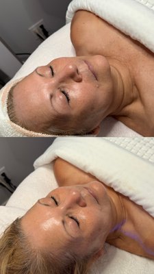 Hydrafacials - Give your skin the ultimate hydration it deserves! At Skin Tonic by Precious, our customized facials and HydraFacials deeply nourish and restore moisture to your skin, leaving it plump, radiant, and refreshed. Each treatment is tailored to your unique skin needs, so you can enjoy long-lasting hydration and a healthy, glowing complexion smooth with aloha.