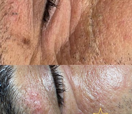 Microblading  Eyebrow powdering, lip tinting eyelash extension  
Our special opening event prices - Hello, I am an esthetician from Turkey. I added some of my works to the pictures. I bought this salon. I am here to do my best to provide you with the best service. Our prices will be affordable for you. Please give us the opportunity to get to know us. I aim to produce great work by using the highest quality products that comply with the hygiene conditions of our salon.