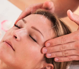 Facial Rejuvenation - Facial acupuncture draws on the practices of Traditional Chinese Medicine, which have been used for thousands of years. Its aim is to promote a youthful, glowing complexion and reduce signs of aging. It is safer and less expensive than surgery or injections. Acupuncture also promotes overall health, which makes it the perfect choice for those who are concerned about the appearance of their face.
Known as Mei Rong (Chinese Medical Cosmetology), cosmetic acupuncture incorporates many therapies such as acupuncture facial rejuvenation, gua sha, cupping therapy, essential oils, LED light therapy, and herbal therapies that address not only your appearance but the whole person, enhancing beauty from within.
Acupuncture for facial rejuvenation can address problems such as sagging skin, acne, hyperpigmentation, poor lymph drainage, and facial tension. Facial Acupuncture helps to stimulate collagen, firm slack muscles, relax overly taut muscles, reduce dark circles, decongest pores, and increase circulation to bring vitality to to your face. Facial Rejuvenation - Facial acupuncture draws on the practices of Traditional Chinese Medicine, which have been used for thousands of years. Its aim is to promote a youthful, glowing complexion and reduce signs of aging. It is safer and less expensive than surgery or injections. Acupuncture also promotes overall health, which makes it the perfect choice for those who are concerned about the appearance of their face.
Known as Mei Rong (Chinese Medical Cosmetology), cosmetic acupuncture incorporates many therapies such as acupuncture facial rejuvenation, gua sha, cupping therapy, essential oils, LED light therapy, and herbal therapies that address not only your appearance but the whole person, enhancing beauty from within.
Acupuncture for facial rejuvenation can address problems such as sagging skin, acne, hyperpigmentation, poor lymph drainage, and facial tension. Facial Acupuncture helps to stimulate collagen, firm slack muscles, relax overly taut muscles, reduce dark circles, decongest pores, and increase circulation to bring vitality to to your face.