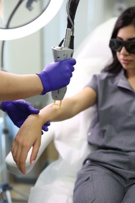 Laser Hair Removal - What is Laser Hair Removal (LHR)?
With our new laser machine,(Candela GentleMax Pro) we can treat all types of skin, but the best candidates have dark hair and light skin.
Nd:YAG can also be used to treat dark or tanned skin with dark hair. Laser treatment doesn't work well on white and light blond hair. People that are not good candidates for this treatment are patients taking Accutane or who have been taking Accutane for the past 6-12 months. People who take daily antibiotics. Anyone who is pregnant or planning on immediately becoming pregnant and anyone who is very tanned (fake or real) or who is sunburnt.
GentleMax Pro by Candela
The GentleMax Pro is a great option for anybody looking to remove unwanted body hair quickly and painlessly. The Nd:YAG 1064nm laser treats darker skin tones whereas the Alexandrite 755nm laser treats lighter skin tones with light and dark thin hair. The Dynamic Cooling Device uses liquid cryogen to minimize the heat and pain associated with hair removal. Rapid pulses are required for the laser to act fast, increasing treatment pain. Overall, the GentleMax Pro machine is incredibly effective, safe, and multifunctional.
Is there down time for LHR?
After your treatment you should be ready to go back to work or go on with your day. In terms of hair removal, you will notice some hairs falling out during or directly after the treatment. Give it about two-three weeks after the treatment for most of the hair to fall out. Just when it is about time for you to reschedule your next appointment. Rare after effects include: redness and some swelling around the follicles which looks similar to large goose bumps after the treatment. If you were exposed to the sun without sunscreen, you may also notice a skin discoloration (hyperpigmentation).
Is Laser Hair removal safe and are the results permanent?
Yes, laser hair removal is 100% safe. There is a very low chance of problems when experienced people use the right laser on the right skin type. Laser hair removal works with infrared light. This causes a lot of heat, but it doesn't damage DNA in the skin cells. It is therefore very unlikely that it will cause cell mutation. After the recommended number of treatments, about 60% to 95% of the hair that was targeted is gone for good.
Do's and Don'ts before and after Laser Hair Removal
BEFORE Laser Hair Removal
- Patients can not be on any antibiotics nor take medications that can produce sensitivity to light.
- Patients must not use fake tan, sunbeds, or expose it's skin to the sun, preferably 4 weeks before the treatment.
- Patients must avoid plucking, waxing or bleaching their hair for 4-6 weeks prior to treatment.
- Patient must shave the area to be treated the night before the appointment which will allow the laser to go directly to the hair follicle.
AFTER Laser Hair Removal
- Apply a thin layer of aloe vera ointment to the treated area several times a day to keep it moist.
- A sunscreen of SPF 30, or preferably a total sun block of SPF 50, must be applied to avoid direct exposure to sunlight which may cause hyperpigmentation if done so.
- Avoid sports and strenuous exercise for two days following the treatment for laser hair removal.
- Avoid very hot baths, showers, steam baths or saunas, and don't swim in strong chlorinated water for two or three days.
- Avoid using bleaching creams or perfume products for 24 to 48 hours.
- Avoid exfoliating or peeling for one week. Laser Hair Removal - What is Laser Hair Removal (LHR)?
With our new laser machine,(Candela GentleMax Pro) we can treat all types of skin, but the best candidates have dark hair and light skin.
Nd:YAG can also be used to treat dark or tanned skin with dark hair. Laser treatment doesn't work well on white and light blond hair. People that are not good candidates for this treatment are patients taking Accutane or who have been taking Accutane for the past 6-12 months. People who take daily antibiotics. Anyone who is pregnant or planning on immediately becoming pregnant and anyone who is very tanned (fake or real) or who is sunburnt.
GentleMax Pro by Candela
The GentleMax Pro is a great option for anybody looking to remove unwanted body hair quickly and painlessly. The Nd:YAG 1064nm laser treats darker skin tones whereas the Alexandrite 755nm laser treats lighter skin tones with light and dark thin hair. The Dynamic Cooling Device uses liquid cryogen to minimize the heat and pain associated with hair removal. Rapid pulses are required for the laser to act fast, increasing treatment pain. Overall, the GentleMax Pro machine is incredibly effective, safe, and multifunctional.
Is there down time for LHR?
After your treatment you should be ready to go back to work or go on with your day. In terms of hair removal, you will notice some hairs falling out during or directly after the treatment. Give it about two-three weeks after the treatment for most of the hair to fall out. Just when it is about time for you to reschedule your next appointment. Rare after effects include: redness and some swelling around the follicles which looks similar to large goose bumps after the treatment. If you were exposed to the sun without sunscreen, you may also notice a skin discoloration (hyperpigmentation).
Is Laser Hair removal safe and are the results permanent?
Yes, laser hair removal is 100% safe. There is a very low chance of problems when experienced people use the right laser on the right skin type. Laser hair removal works with infrared light. This causes a lot of heat, but it doesn't damage DNA in the skin cells. It is therefore very unlikely that it will cause cell mutation. After the recommended number of treatments, about 60% to 95% of the hair that was targeted is gone for good.
Do's and Don'ts before and after Laser Hair Removal
BEFORE Laser Hair Removal
- Patients can not be on any antibiotics nor take medications that can produce sensitivity to light.
- Patients must not use fake tan, sunbeds, or expose it's skin to the sun, preferably 4 weeks before the treatment.
- Patients must avoid plucking, waxing or bleaching their hair for 4-6 weeks prior to treatment.
- Patient must shave the area to be treated the night before the appointment which will allow the laser to go directly to the hair follicle.
AFTER Laser Hair Removal
- Apply a thin layer of aloe vera ointment to the treated area several times a day to keep it moist.
- A sunscreen of SPF 30, or preferably a total sun block of SPF 50, must be applied to avoid direct exposure to sunlight which may cause hyperpigmentation if done so.
- Avoid sports and strenuous exercise for two days following the treatment for laser hair removal.
- Avoid very hot baths, showers, steam baths or saunas, and don't swim in strong chlorinated water for two or three days.
- Avoid using bleaching creams or perfume products for 24 to 48 hours.
- Avoid exfoliating or peeling for one week.