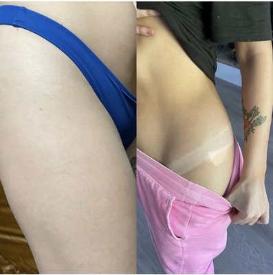 SPRAY TAN PICTURES - The spray tan product that I use is designed to diminish the chance of allergic reactions, reduce clogged pores and acne breakouts. Eliminates the staining of clothes or bed sheets and comes in different DHA concentrations and colors to suit every skin type for the most natural looking tan. SPRAY TAN PICTURES - The spray tan product that I use is designed to diminish the chance of allergic reactions, reduce clogged pores and acne breakouts. Eliminates the staining of clothes or bed sheets and comes in different DHA concentrations and colors to suit every skin type for the most natural looking tan.