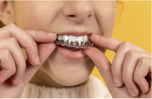 Orthodontics - we offer comprehensive orthodontics for patients of all ages to help them achieve the smile they want. Whether your child needs traditional braces or you want to learn more about clear aligner therapy, we can help so everyone in your family achieves a beautiful smile.