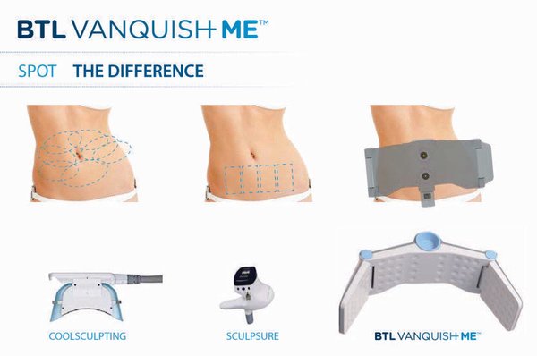 VanquishME - The best results from VanquishME