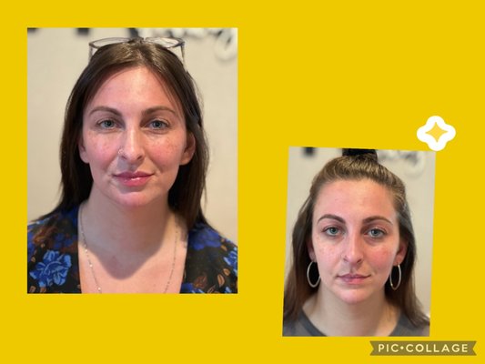 Accepting new clients! - Offering free consultations and 10% off your first treatment