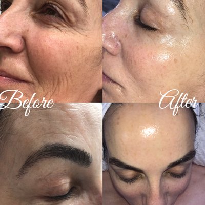 Healthy & Glowing Skin Condition - MT Skin Clinic offers the latest advancements in modern skin care, combining organic-based facials and cutting-edge clinical treatments. Skin is transformed with long lasting results. MT Skin Clinic also offers various beauty enhancing services such as anti-aging, acne treatment, scaring remove and rejuvenation for the skin, eyelash extensions, and more. Healthy & Glowing Skin Condition - MT Skin Clinic offers the latest advancements in modern skin care, combining organic-based facials and cutting-edge clinical treatments. Skin is transformed with long lasting results. MT Skin Clinic also offers various beauty enhancing services such as anti-aging, acne treatment, scaring remove and rejuvenation for the skin, eyelash extensions, and more.