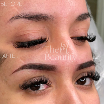 Ombré Powder Brows - Ombre Powder Brows is a semi-permanent cosmetic tattooing technique that creates a soft, shaded brow pencil look. It gives great definition and depth to the eyebrows and is particularly beneficial for individuals with sparse or thinning brows. The result is a natural, fuller-looking brow that lasts for up to a few years.