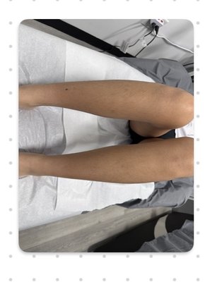 Waxing (Soft Wax) - Waxing - Used soft wax to remove hair (full leg/ half leg) Waxing (Soft Wax) - Waxing - Used soft wax to remove hair (full leg/ half leg)