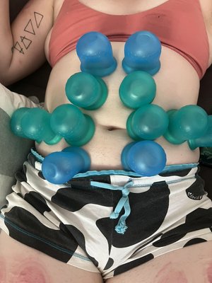 Cupping to the max! - Cupping is a traditional Chinese medicine that dates back almost 5000 years. 

Increases mobility 
Decrease pain/tension 
Promotes cell repair and blood/oxygen flow!