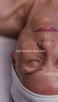 Facials - SWiCH by Circadia is a professional-grade dermal rejuvenation treatment protocol from Circadia that offers a gentler, no-downtime alternative to traditional chemical peels. Instead of causing controlled injury to the skin to trigger repair, SWiCH works by boosting the skin’s natural cellular energy and repair systems to deliver visible anti-aging results. Facials - SWiCH by Circadia is a professional-grade dermal rejuvenation treatment protocol from Circadia that offers a gentler, no-downtime alternative to traditional chemical peels. Instead of causing controlled injury to the skin to trigger repair, SWiCH works by boosting the skin’s natural cellular energy and repair systems to deliver visible anti-aging results.