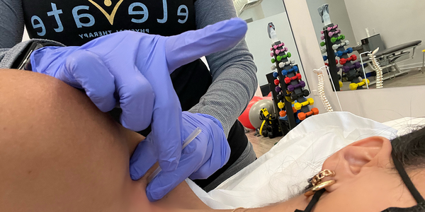 Trigger Point Dry Needling - What is dry needling? Dry needling is an alternative way to alleviate pain without relying on medication. It is a safe and simple procedure to target pain points and help restore range of motion, improve function and decrease pain.

What is a trigger point? Trigger Points are contractures (knots) of muscles that can be felt as with a taut band, or tender nodes in certain areas of the muscles. These areas can be painful even without having direct pressure on them.

Elevate PT physical therapists are trained to not only identify trigger points in the muscle, but also treat them by introducing microfilament needles to the areas of tightness to help release the muscle.

How do I know if dry needling is an option for pain relief for me? Our physical therapists can evaluate and help to guide you to a decision that best fits your needs. Dry Needling is a great alternative to help relieve pain especially in hard to reach areas of the body.

Does Dry Needling Hurt? – Like with any procedure, whether or not you experience pain can differ from person to person. Some patients claim that they don’t feel any pain, while others say they can feel a moderate pain in the treated area. Patients also say that they can feel an instant relief in the muscle, with some tenderness later on. Your physical therapist will go over all options and possible outcomes with you to ensure you make the best decision for your body.

How does dry needling differ from acupuncture? Dry needling goes deeper into the muscle specifically and treats localized areas of soft tissue pain.

Elevate Physical Therapy believes in the education of our patients to self manage and treat their pain symptoms without requiring the need of a healthcare professional everytime pain occurs. Our physical therapists utilize dry needling as another alternative way to target & relieve pain areas without the use of medication. We also provide many other ways to manage and alleviate pain for our patients, and work with them to find the best path for their daily life.