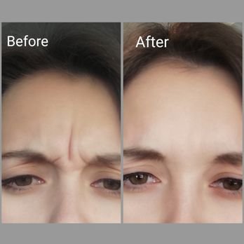 Aesthetics - Sports Spa offers Botox (Dysport or Botox), Fillers, PRP For Facial Treatment, and Shockwave Therapy for unwanted Cellulite. To get more information or to get a quote please visit our website and contact us via email or phone. Aesthetics - Sports Spa offers Botox (Dysport or Botox), Fillers, PRP For Facial Treatment, and Shockwave Therapy for unwanted Cellulite. To get more information or to get a quote please visit our website and contact us via email or phone.