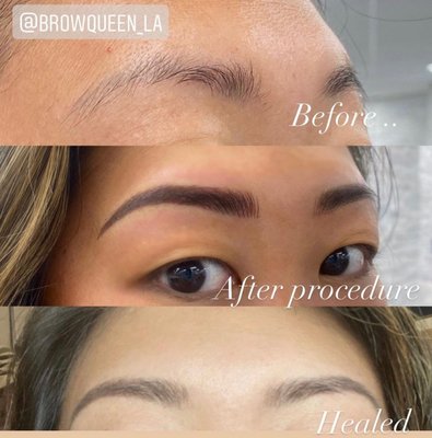 Before and After Microblading - This is an example of before and after pictures of our microblading procedure including the process of brow mapping where we along with our customers determine the perfect shape for the brows.