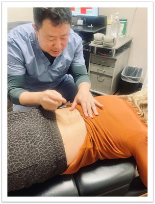 Acupuncture + Chiropractic - The patient came in with low back pain from an injury. Our treatment plan included Chiropractic treatment to properly align the spine, followed by Acupuncture and Electrical Muscle Stimulation to promote healing. After one treatment the patient was provided significant relief, and after a series of three treatments the pain had completely subsided,