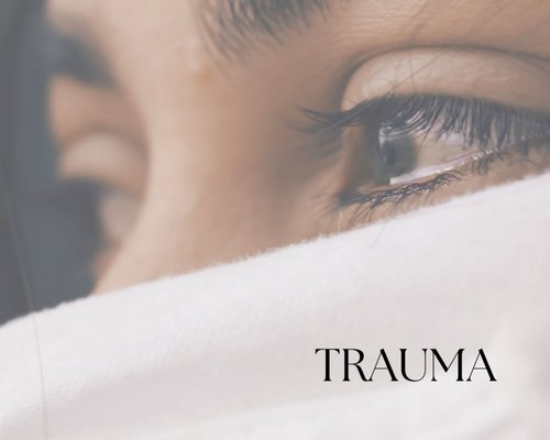 Trauma - Trauma is a psychological or emotional response to an event or experience that is deeply distressing or disturbing. Trauma can be categorized into different types based on the nature of the experience. Some common types include:
Acute Trauma: This results from a single traumatic event, such as a car accident or a natural disaster.
Chronic Trauma: This occurs as a result of prolonged exposure to stressful or traumatic situations, such as ongoing abuse, neglect, or living in a war zone.
Complex Trauma: This involves exposure to multiple traumatic events, often of an interpersonal nature, over an extended period. Examples include childhood abuse, domestic violence, or being a refugee.
Developmental Trauma: This refers to trauma that occurs during critical periods of development, such as childhood, and can have lasting effects on psychological and emotional functioning.
Trauma can have significant and long-lasting effects on various aspects of a person's life, including mental health, physical health, interpersonal relationships, self-esteem and identity. Trauma treatment usually involves therapy, medications, support groups, and self-care.
If you are looking for a therapist that provides trauma-informed care by prioritizing safety, collaboration, and empowerment, then call Anu at Soul Alchemi Psychotherapy. Trauma - Trauma is a psychological or emotional response to an event or experience that is deeply distressing or disturbing. Trauma can be categorized into different types based on the nature of the experience. Some common types include:
Acute Trauma: This results from a single traumatic event, such as a car accident or a natural disaster.
Chronic Trauma: This occurs as a result of prolonged exposure to stressful or traumatic situations, such as ongoing abuse, neglect, or living in a war zone.
Complex Trauma: This involves exposure to multiple traumatic events, often of an interpersonal nature, over an extended period. Examples include childhood abuse, domestic violence, or being a refugee.
Developmental Trauma: This refers to trauma that occurs during critical periods of development, such as childhood, and can have lasting effects on psychological and emotional functioning.
Trauma can have significant and long-lasting effects on various aspects of a person's life, including mental health, physical health, interpersonal relationships, self-esteem and identity. Trauma treatment usually involves therapy, medications, support groups, and self-care.
If you are looking for a therapist that provides trauma-informed care by prioritizing safety, collaboration, and empowerment, then call Anu at Soul Alchemi Psychotherapy.