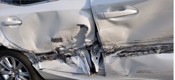Car Accident Photos - These photos are examples of the wide range of car accidents we have handled for our clients. Insurance companies often try to devalue cases based on the level of damage to the vehicle.  It is important to understand that you may suffer serious and significant bodily injuries despite there being minor damage to your vehicle. This is why it is important to contact an attorney that has experience dealing with insurance companies.  Every case is unique and our attorneys work with you every step of the way to guide you through the process.  Contact us today for a FREE consultation and case evaluation.