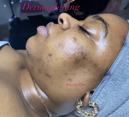 Skin care Treatment - Skin care treatment Skin care Treatment - Skin care treatment