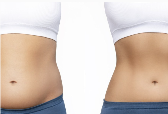 Weight Loss and Slimming - You may be struggling to shed those last stubborn 10 pounds, but if you've experienced the yo-yo effect of losing and gaining weight, you may not be feeling your best. While others may say you look great, we understand that you're seeking that extra boost to truly look and feel amazing - and we have a solution for you Weight Loss and Slimming - You may be struggling to shed those last stubborn 10 pounds, but if you've experienced the yo-yo effect of losing and gaining weight, you may not be feeling your best. While others may say you look great, we understand that you're seeking that extra boost to truly look and feel amazing - and we have a solution for you