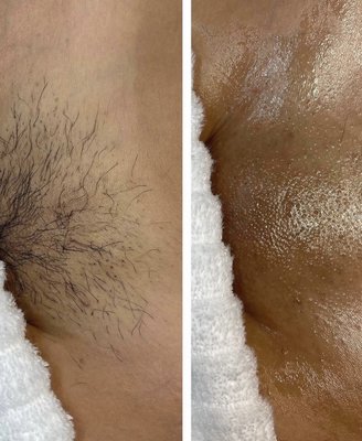 Waxing with all Natural Ingredients - Self-care starts with ingredients you trust. Our wax is all-natural, ultra-gental, and made to soothe.