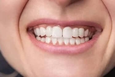 Restorative - With restorative dental care, we help our patients from all over the area restore their smiles after damage has taken place, or achieve their goals of more attractive smiles. Restorative - With restorative dental care, we help our patients from all over the area restore their smiles after damage has taken place, or achieve their goals of more attractive smiles.