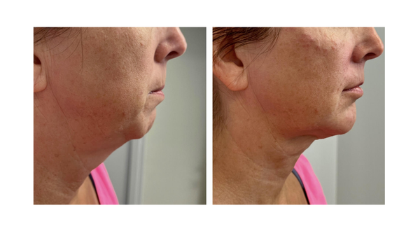 Before & After - Before and Afters, Book today!