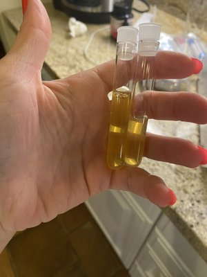 PRP Service - Experience luxury skincare with our rejuvenating serum treatment. Crafted to hydrate, revitalize, and give your skin a radiant, youthful glow. PRP Service - Experience luxury skincare with our rejuvenating serum treatment. Crafted to hydrate, revitalize, and give your skin a radiant, youthful glow.