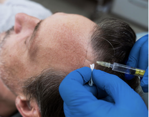 Come check us out today! - Our goal at MD MedSpa is to provide individualized care to help you achieve your medical aesthetic goals in a very comfortable and cozy environment by offering the latest and effective treatment options in aesthetic care. We offer Botox, PRP treatments, Microneedling and much more! Call today to book your free consultation! Come check us out today! - Our goal at MD MedSpa is to provide individualized care to help you achieve your medical aesthetic goals in a very comfortable and cozy environment by offering the latest and effective treatment options in aesthetic care. We offer Botox, PRP treatments, Microneedling and much more! Call today to book your free consultation!