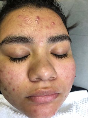 Personalized facials (90 min)
Hydro facial (50 min)
European facial (60 min) - We analyze your skin type and recommend the perfect facial that fits you ! Personalized facials (90 min)
Hydro facial (50 min)
European facial (60 min) - We analyze your skin type and recommend the perfect facial that fits you !