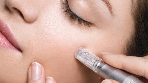 Microneedling - Transform your skin's texture and appearance with the rejuvenating power of microneedling for your skin
Our minimally invasive procedure, utilizing an FDA-approved device, is designed to enhance collagen production safely and effectively. Contact us today for a consultation and embrace a more youthful, radiant complexion.
Microneedling: The Key to Enhanced, Youthful Skin
Microneedling is a minimally invasive, transformative procedure designed to rejuvenate your skin. Using an FDA-approved handheld device with sterilized needles it creates precise, tiny wounds. This process stimulates the body's natural healing, enhancing collagen, elastin, and fibroblast production. Microneedling - Transform your skin's texture and appearance with the rejuvenating power of microneedling for your skin
Our minimally invasive procedure, utilizing an FDA-approved device, is designed to enhance collagen production safely and effectively. Contact us today for a consultation and embrace a more youthful, radiant complexion.
Microneedling: The Key to Enhanced, Youthful Skin
Microneedling is a minimally invasive, transformative procedure designed to rejuvenate your skin. Using an FDA-approved handheld device with sterilized needles it creates precise, tiny wounds. This process stimulates the body's natural healing, enhancing collagen, elastin, and fibroblast production.