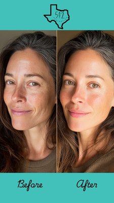 TOX - Anti-Wrinkle - Experience a refreshed and youthful appearance with our precision Neurotoxin treatments. Our 'Tox' services are tailored to smooth fine lines and wrinkles while maintaining natural facial expressions. We prioritize a conservative approach to ensure you look like yourself—just more rested. This project highlights a typical 'frown line' or 'crow’s feet' treatment with results visible within 7-14 days TOX - Anti-Wrinkle - Experience a refreshed and youthful appearance with our precision Neurotoxin treatments. Our 'Tox' services are tailored to smooth fine lines and wrinkles while maintaining natural facial expressions. We prioritize a conservative approach to ensure you look like yourself—just more rested. This project highlights a typical 'frown line' or 'crow’s feet' treatment with results visible within 7-14 days