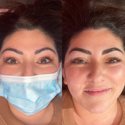 Brow Coverups - Combo brows or powder brows are generally best for coverups. We are not able to do all coverups, please give us a call to discuss any brow corrections.