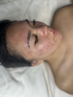 Facials - some of the Facials offered here at Wolfe Aesthetics. Prices range from $49-$250+! Here to fit everyone’s budget✨ Facials - some of the Facials offered here at Wolfe Aesthetics. Prices range from $49-$250+! Here to fit everyone’s budget✨