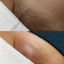Body waxing - From eyebrow to full body hair removal.