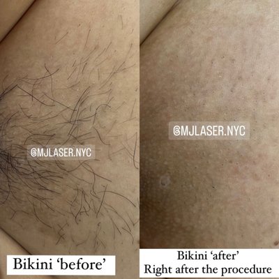 Before/After - Some before and after pictures, more you can find on our Instagram page