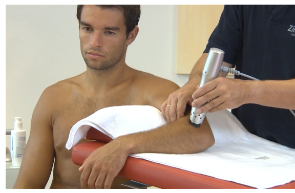 Shock Wave Therapy - The enPuls device delivers mechanical energy into the target tissue. The energy will treat muscle pain and help increase the circulation in the area being treated. It also affects the tissue tone in a positive way making your clinicians other therapies more effective.
Your chronic pain may be related to scar tissue and adhesions formed either in soft tissue or tendon / ligament post injury. A treatment with the enPuls effectively presses the reset button on chronic scarred and hard-to-treat soft tissue. Scar tissue or adhesions in many cases adheres to and puts pressure on nerves which can result in pain. By breaking up the scarring and adhesions this helps take the pressure off the nerve and increases circulation to the area which helps the body heal itself more efficiently. Plus, this will help with range of motion. Shock Wave Therapy - The enPuls device delivers mechanical energy into the target tissue. The energy will treat muscle pain and help increase the circulation in the area being treated. It also affects the tissue tone in a positive way making your clinicians other therapies more effective.
Your chronic pain may be related to scar tissue and adhesions formed either in soft tissue or tendon / ligament post injury. A treatment with the enPuls effectively presses the reset button on chronic scarred and hard-to-treat soft tissue. Scar tissue or adhesions in many cases adheres to and puts pressure on nerves which can result in pain. By breaking up the scarring and adhesions this helps take the pressure off the nerve and increases circulation to the area which helps the body heal itself more efficiently. Plus, this will help with range of motion.