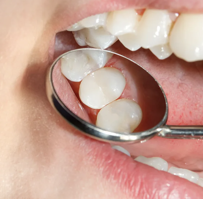 Restorative Dentistry - Keep your smile feeling and functioning at its absolute best with restorative dentistry. From simple procedures like dental fillings, to more complex solutions like dental prosthetics and root canal therapy, restorative dentistry aims to revitalize decayed or damaged teeth. With our comprehensive restorative care, you can take back your overall oral health so you can eat, laugh, and smile with confidence. Restorative Dentistry - Keep your smile feeling and functioning at its absolute best with restorative dentistry. From simple procedures like dental fillings, to more complex solutions like dental prosthetics and root canal therapy, restorative dentistry aims to revitalize decayed or damaged teeth. With our comprehensive restorative care, you can take back your overall oral health so you can eat, laugh, and smile with confidence.