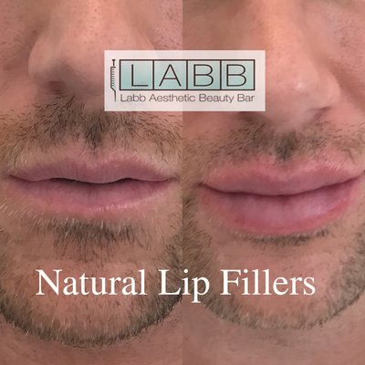 THE LABB BEAUTY ( FOUNTAIN OF YOUTH HOT SPOT in MIAMI BEACH ) - THE LABB BEAUTY Master Injectors are trained professionals here for you when you want. If you are looking for the best please call us for an appointment. 305 934 1391